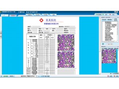 骨髓细胞图文报告系统软件   骨髓细胞图文影像工作站