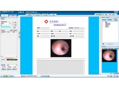 乳管镜医学影像工作站  乳管镜图像管理系统软件
