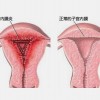 （仁心仁术）小官庄卫生所-青州输卵管阻塞不孕专科