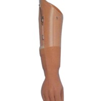 辽宁上臂假肢哪家好-报价合理的上臂假肢沈阳佳奥假肢矫形供应