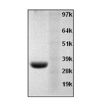 重组Annexin V 蛋白 CAS 136107-94-3